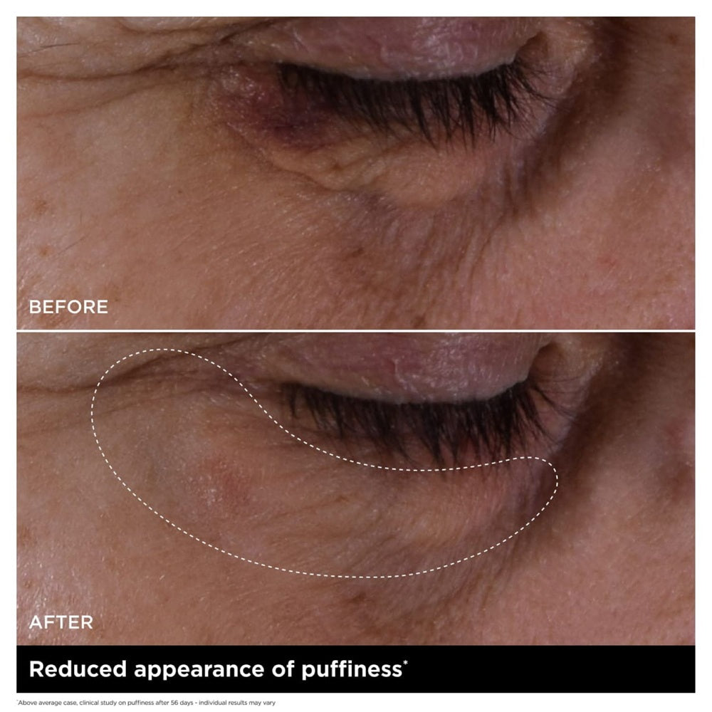 Double Serum Eye