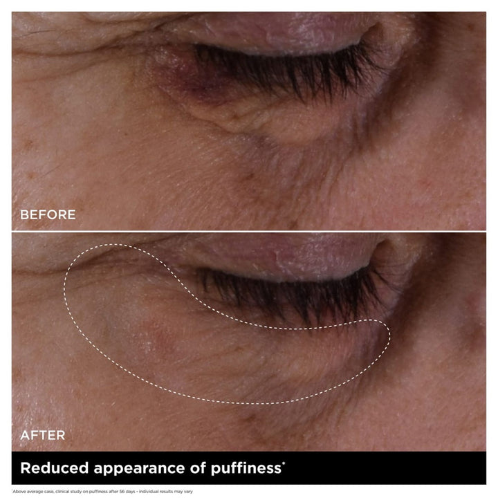 Double Serum Eye