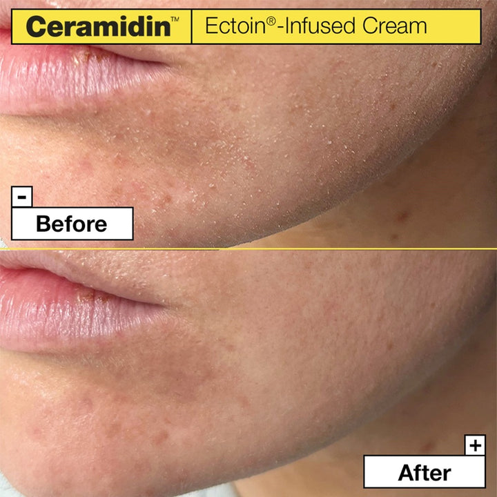 Ceramidin Ectoin-Infused Cream