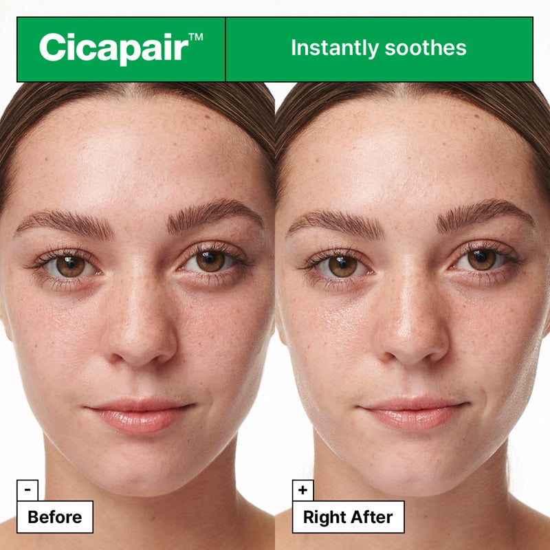 Cicapair Intensive Soothing Repair Serum