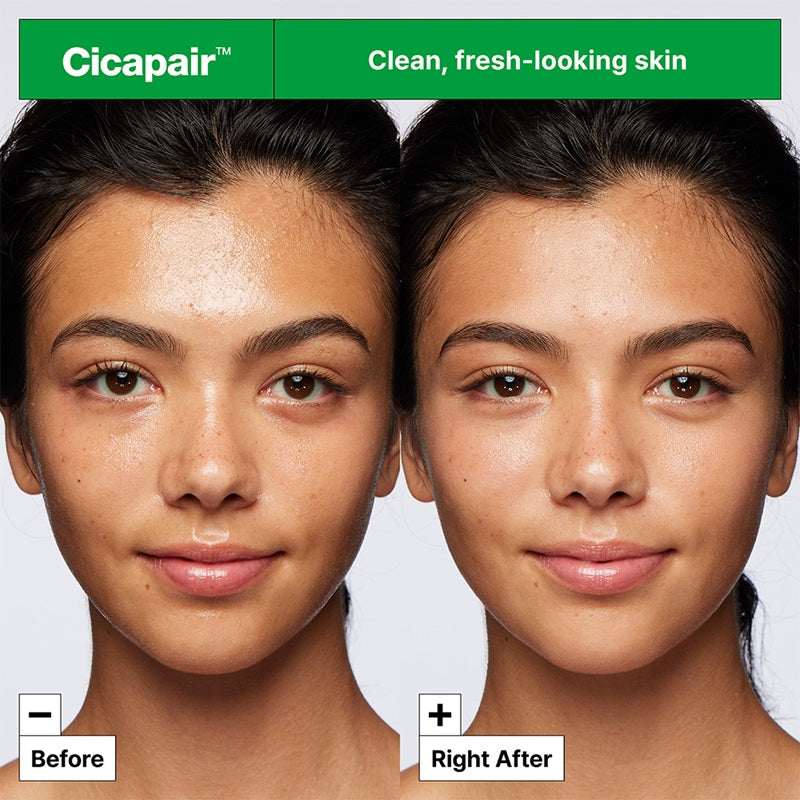Cicapair Gentle Cleansing Foam